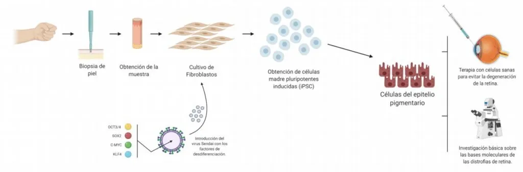Decoded the mechanism of a mutation that alters chlorine levels in the retina
